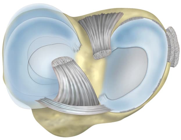 Meniscus Repair & Preservation